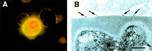 Fig. 1. Binding of heparin-conjugates to surfaces of infected erythrocytes. / (A) Heparin–FITC was allowed to bind to a living culture. The pRBC were counterstained with ethidium bromide and visualized by UV microscopy. (B) For electron microscopy, heparin-albumin-gold particles were applied to the specimen as described in “Materials and methods.” Photograph shows cell surface of uninfected RBC (upper part) and pRBC (lower part). The scale bar represents 0.2 μm.