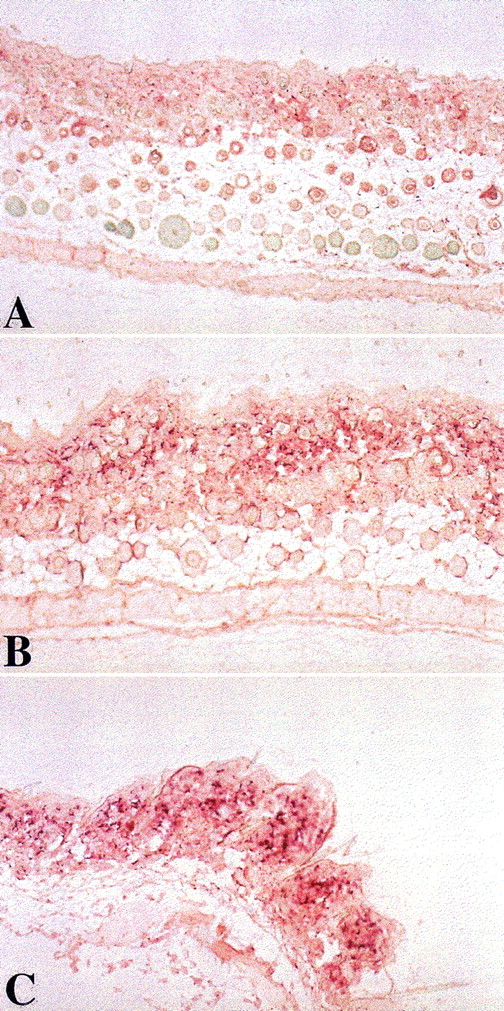 Fig. 2. Induction of oral tolerance in splenocyte recipients toward pretransplant recipient lymphocytes decreased skin collagen production. / Skin biopsies were performed on splenocyte recipients 52 days after transplantation. Skin collagen α1 mRNA content was determined by in situ hybridization of skin section with a mouse collagen α1(I) probe. Mice in experimental group A, fed with homogenates of splenocytes derived from recipient strain BALB/c mice, 7 days after transplantation, showed much less collagen α1 (I) gene expression (panel A). In contrast, control nontolerant recipients in groups B and C, fed after transplantation, with homogenates prepared from B10.D2 mouse splenocytes or BSA, respectively, showed significantly higher levels of collagen αI gene expression (panels B and C). (Original magnification ×10.)