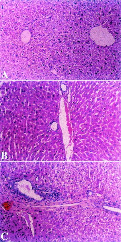 Fig. 3. Effect of toleration on histologic evaluation of liver in transplants recipients. / Liver biopsies were performed on splenocyte recipients 52 days after transplantation. Mice in experimental group A, fed after transplantation with homogenates of splenocytes derived from recipient strain BALB/c mice showed mild degree of portal inflammation (Panel A). In contrast, biopsies from control nontolerant recipients in groups B and C, fed after transplantation with homogenates prepared from B10.D2 mouse splenocytes or BSA, respectively, showed portal and bile duct inflammation (Panels B and C). (HαE, original magnification ×40.)