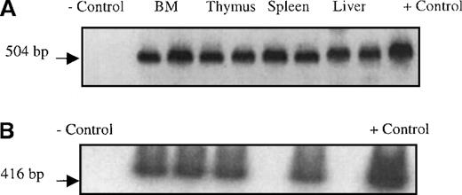 Fig. 7. PCR on isolated tissues. / (A) Presence of NeoR gene in hematopoietic organs from sheep transplanted in utero with retrovirally marked stromal cells. Following sacrifice, single cell suspensions of liver, spleen, thymus, and BM were prepared as detailed in “Materials and methods,” and the DNA obtained from these cells was then subjected to PCR analysis with primers specific for the vector-encodedNeoR gene. The reagent control consisted of all of the constituents of the PCR reaction mixture except template DNA (lane 1 from the left). The negative control (−) DNA was isolated from the PB mononuclear cells from a normal control ram (lane 2). The positive control consisted of the plasmid pUC18Neo diluted in normal sheep DNA to a concentration of 1% (lane 11). The remainder of the samples consisted of DNA extracted from the organs (as labeled in the figure) of 2 different transplanted sheep. For each organ there are 2 samples; the sample on the left is from the time point of 2 weeks after transplant, and the sample on the right from 6 weeks after transplant. (B) SCF RT-PCR on marrow stromal cells. To evaluate whether the transplanted stromal cells were expressing mRNA for hematopoietic growth factors BM stromas grown from 5 sheep transplanted with human stroma cells alone were harvested and RNA was isolated. This RNA was then reverse transcribed into cDNA and used as a template for SCF-specific PCR. The reagent control consisted of all of the reaction constituents except template DNA, and the negative control consisted of RNA isolated from the BM mononuclear cells of a normal control sheep (lane 1). The positive control was RNA isolated from human BM mononuclear cells (lane 8). Lanes 2 to 6 consisted of RNA extracted from stromal layers cultured from BM of 5 different sheep injected with human stromal cells alone. In all but 1 animal (lane 5) we were able to detect mRNA for SCF. We were able, however, to amplify a fragment of β-actin message from this sample demonstrating the presence of intact RNA.