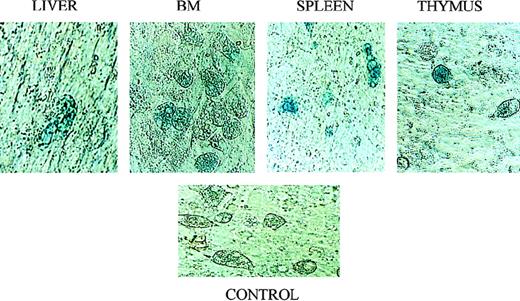 Fig. 8. X-galactosidase staining confirms engraftment of transplanted stromal cells in multiple hematopoietic organs. / Following transplantation in utero with retrovirally marked stromal cells, sheep were killed and stromal layers established in vitro from their liver, spleen, thymus, and BM. These layers were then evaluated for expression of the vector-encoded LacZ gene by histochemical X-galactosidase staining according to standard procedures. See text for details. The control consisted of a stromal layer derived from the BM of a normal control sheep that was processed and stained identically to the experimental samples.