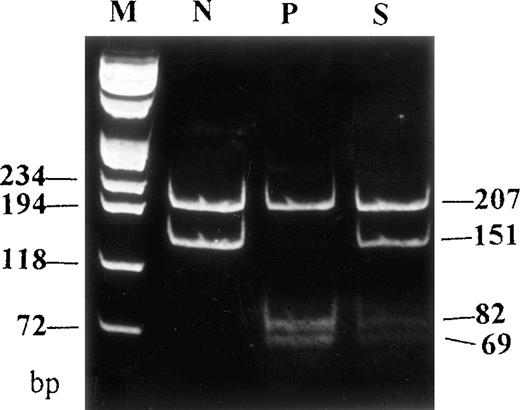 Fig. 2. Genomic DNA fragments of FVII amplified by PCR were digested with HgiC I endonuclease and electrophoresed on a 12% polyacriminate gel. / Another HgiC I endonuclease restriction site was generated by a T → G mutation at codon 329 of the FVII gene, leading to the occurrence of 3 fragments (207, 82, and 69 bp) in the patient, instead of 2 fragments (207 and 151 bp) in the healthy subject. A heterozygous restriction pattern was shown in the patient's son. M indicates DNA markers (πx174/Hae III); N, normal subject; P, patient; S, patient's son.