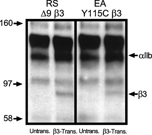 Fig. 1. Immunoprecipitation analysis of −889PlA2β3 transduced CD34+cells from patient RS▵9β3 and EAY115Cβ3. / Cells (5 × 105) were collected 10 and 15 days, respectively, after transduction and detergent lysates were immunoprecipitated with 10 μg of an αIIbβ3 complex-specific antibody (AP2). The complexed proteins were separated on a 7% SDS-PAGE gel under nonreducing conditions. Immunoanalysis using polyclonal antibodies to αIIb and β3 followed by chemiluminescence detection showed that transduction with the −889PlA2β3 vector resulted in the synthesis of detectable levels of β3and αIIb (arrows on right), whereas untransduced samples did not have detectable protein. Molecular mass markers are in kilodaltons (left). Additional bands appearing equally in each lane are nonspecific background resulting from chemiluminescence detection using a murine monoclonal antibody for immunoprecipitation and rabbit polyclonal antibodies and a horseradish peroxidase-conjugated donkey antirabbit antibody for analysis.