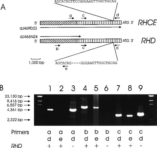 Fig. 2. Chromosomal organization of the DNA regions located 5′ to the RHD and RHCE genes. / (A) The proposed structure of the RHCE and RHD 5′ flanking regions is depicted. A total of 4941 bp immediately 5′ of the ATG start codons are homologous between the RHCE andRHD genes (vertically hatched bars). No homology is present beyond this homology region (diagonally hatched bars). We used 2 genomic clones, dJ469D22 and dJ465N24, for primer design. DJ469D22 comprises the full length of the depicted RHCE region, whereas dJ465N24 extends only 466 bp into the homology region. The positions of several PCR primers are indicated: a, rey14a; b, rend32; c, rey15a; d, re014; and e, re011d. (B) This proposed structure is supported by several PCR reactions. Forward priming was done with primer a (RHCE specific, lane 1-3), primer b (RHD specific, lane 4-6), and primer c (RHCE and RHD homology region, lane 7-9). Amplicons were lacking for primer a with RHD-specific reverse primer e (lane 2) and for primer b withRHD− DNA (lane 6). The other 7 PCR reactions yielded amplicons of the predicted sizes in accordance with the genomic structure shown in panel A.
