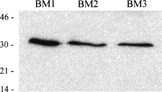 Fig. 9. Immunoblot analysis of TRAIL protein expression in human BM mononuclear cells. / Whole cell lysates of human BM mononuclear cells from 3 different donors were tested with anti-TRAIL antibody (clone B35-1). Molecular mass markers are indicated (kDa).