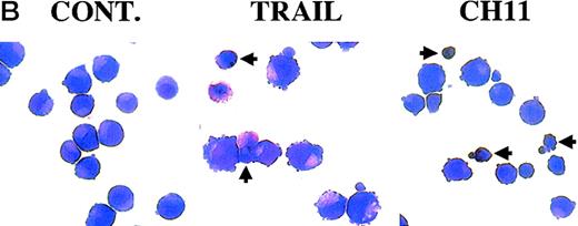 Fig. 3. TRAIL-mediated induction of apoptosis in erythroid precursors at intermediate stages of differentiation. / Seven-day unilineage erythroid (SCF + IL-3 + EPO) (A and B) and megakaryocytic (IL-3 + TPO) (A) cultures were incubated with irrelevant IgM mAb and rHis6-tag peptide (CONT), TRAIL, or anti-CD95 (CH 11) IgM mAb for 20 hours. (A) Erythroid and megakaryocytic cells were phenotypically characterized by double staining with anti-CD71 + anti-glycophorin A or anti-CD41 + anti-CD42b, respectively (upper 2 panels). Percentages of glycophorin A+ and CD41+ cells are indicated in each panel. Apoptotic erythroid cells were detected by staining with annexin V combined to glycophorin A, whereas apoptotic megakaryocytes were detected by propidium iodide staining combined to CD61 (lower 6 panels). Percentages of cells in the respective quadrants are indicated. Quadrants were set based on negative controls stained with isotype-matched irrelevant mAbs (not shown). Panel (B) shows the morphological analysis of erythroblasts stained with May-Grunwald-Giemsa. Apoptotic cells are indicated by arrowheads. Original magnification 600×.