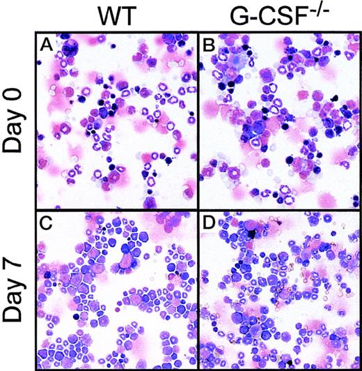 Fig. 2. Bone marrow cells. / Cytocentrifuge preparation of bone marrow cells at baseline (top panel) and 7 days after candida challenge (bottom panel) from wild-type (A, C) and G-CSF–deficient (B, D) mice. The cytospin preparations were stained with May-Grünwald-Giemsa stain.