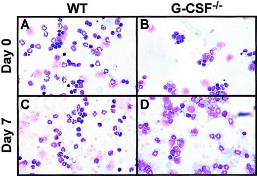 Fig. 5. Two-color flow cytometric analysis of peripheral blood mononuclear cells at baseline and 7 days after candida infection. / Peripheral blood mononuclear cells from (A) wild-type, (B) G-CSF−/−, (C) G-CSF−/−/GM-CSF−/− , and (D) G-CSF−/−/IL-6−/−mice were incubated with Mac-1 and Gr-1 antibodies. An increase in proportion of granulocytic cells (Gr-1 and Mac-1 double positive cells) is seen in mice of all genotypes after candida infection.