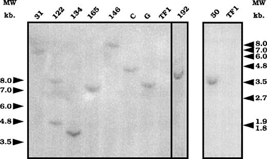 Fig. 3. Southern blot analysis of the number of integrations. / Genomic DNA prepared from the different clones was digested withEcoR1 and submitted to a Southern blot analysis using a lacZ probe. DNA from uninfected cells was used as a control for hybridization (lane TF1). Numbers and letters at the top represent the different clones. Arrows represent the molecular weight markers in kilobase (kb).