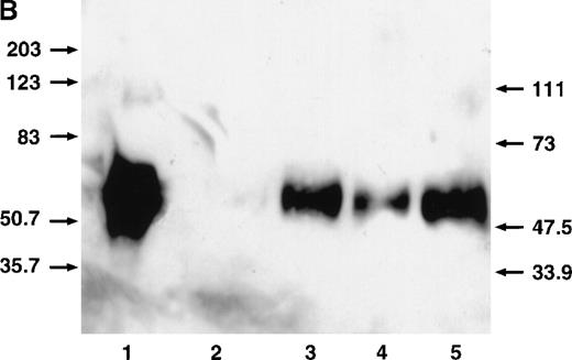 Fig. 5. CD40L stimulates the production of TPO by stromal cells. / (A) ELISA on 48-hour-old conditioned medium in ECs, BMEC line LTBMCs, bone marrow-derived myofibroblasts cultured in the presence of 10% supernatant of nontransfected COS cell (left histogram), or with 10% supernatant of CD40L-CD8α–transfected COS cells (right histogram). No TPO was detected in untransfected or transfected COS cell supernatants. Results are expressed as the mean ± SD for 3 experiments. (B) Western blotting showing TPO protein in HUVEC- and LTBMC-culture medium and increased production by CD40L. 1, recombinant TPO protein, 2 and 4, LTBMCs and HUVECs, respectively, cultured in the presence of 10% supernatant of nontransfected COS cells; 3 and 5, LTBMCs and HUVECs respectively, cultured with 10% supernatant of CD40L-CD8α– transfected COS cells. TPO was found migrating at an Mr of 58 to 68 kd. An additional species migrating at an Mr of approximately 90 kd (visible in track 1) can be seen on overloading and/or overexposure. We do not know the nature of this high-molecular weight species. Dotted line indicates the level of the lowest TPO standard (31.2 pg/mL).