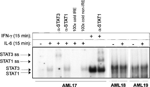 Fig. 2. Electrophoretic mobility shift assay of AML samples. / AML cells (patients 17, 18, 19) were either unstimulated or stimulated with 10 ng/mL IL-6 or IFN-γ as indicated. Nuclear extracts were isolated and analyzed for Stat3 binding activity by electrophoretic mobility shift assay using a 32P-labeled IRE probe from the human ICAM promoter. Supershift assays were performed using antibodies against Stat1 and Stat3, and in competition experiments a 100-fold molar excess of IRE or an aspecific probe was used.