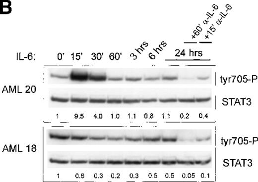 Fig. 3. Treatment with anti-IL-6 but not anti-IL-1 blocks constitutive Stat3 phosphorylation and restores IL-6 inducibility. / (A) AML cells (patient 19) were cultured in 12-well plates and pretreated with either anti-IL-6 (1:1000) or left untreated. After 24 hours, cells were washed and were left unstimulated or were stimulated with 10 ng/mL IL-6 for 15 minutes. (B) AML cells (patients 18, 20) were cultured in 12-well plates and stimulated with 10 ng/mL IL-6 for several time periods as indicated. After 24 hours, cells were treated with anti-IL-6 (1:1000) as indicated for 15 or 60 minutes. Equal amounts of total cell lysates were subjected to SDS–PAGE, followed by Western blot analysis as described in A. (C) AML cells (patient 18) cultured in 12-well plates were either pretreated with anti-IL-1 (1:250) overnight or left untreated. After 24 hours, cells were washed and stimulated with 10 ng/mL IL-6 for 15 minutes as indicated. Equal amounts of total cell lysates were Western blotted as described in A.