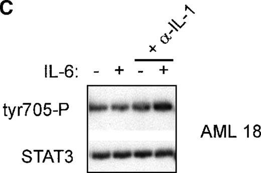 Fig. 3. Treatment with anti-IL-6 but not anti-IL-1 blocks constitutive Stat3 phosphorylation and restores IL-6 inducibility. / (A) AML cells (patient 19) were cultured in 12-well plates and pretreated with either anti-IL-6 (1:1000) or left untreated. After 24 hours, cells were washed and were left unstimulated or were stimulated with 10 ng/mL IL-6 for 15 minutes. (B) AML cells (patients 18, 20) were cultured in 12-well plates and stimulated with 10 ng/mL IL-6 for several time periods as indicated. After 24 hours, cells were treated with anti-IL-6 (1:1000) as indicated for 15 or 60 minutes. Equal amounts of total cell lysates were subjected to SDS–PAGE, followed by Western blot analysis as described in A. (C) AML cells (patient 18) cultured in 12-well plates were either pretreated with anti-IL-1 (1:250) overnight or left untreated. After 24 hours, cells were washed and stimulated with 10 ng/mL IL-6 for 15 minutes as indicated. Equal amounts of total cell lysates were Western blotted as described in A.
