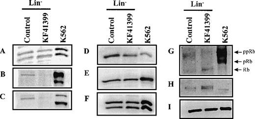 Fig. 6. KF41399 administration modulated the expression level of cell cycle regulating proteins in Lin− cells. / Mice were treated with 25 mg/kg KF41399 orally twice daily for 3 days (protocol B, Table 1). Control animals were administered distilled water instead of KF41399. Lin− cells were purified on day 3, and cell lysate was prepared. The expression level of each protein was detected as described in “Materials and methods.” Cyclin D1 (A), cyclin E (B), cyclin A (C), Cdk4 (D), Cdk6 (E), Cdk2 (F), Rb (G), p130 (H), and β-actin (I). Phosphorylation status of Rb was shown as ppRb (hyper-phosphorylated Rb), pRb (hypo-phosphorylated Rb), and Rb (unphosphorylated Rb).