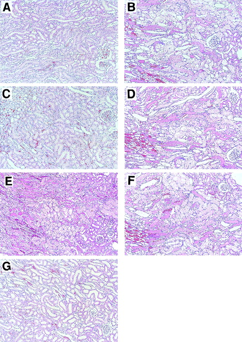 Fig. 3. Effects of APC, DEGR-FXa, heparin, DIP-APC, and leukocytopenia on renal histological feature in rats that had I/R. / Rats were subjected to 60 minutes of renal ischemia followed by reperfusion. Results are shown in rats in the sham-operation group (A and H), rats treated with I/R plus saline (B and I), rats treated with I/R plus APC (C and J); rats treated with I/R plus DEGR-FXa (D and K), rats treated with I/R plus heparin (E and L), rats treated with I/R plus DIP-APC (F and M), and rats treated with I/R and induction of leukocytopenia (G and N). For A, B, C, D, E, F, G, original magnification ×100; for H, I, J, K, L, M, and N, original magnification ×400.