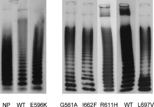 Fig. 2. Multimer analysis of rvWF-WT, type 2M and type 2B rvWFs. / rvWF multimers were resolved by 0.1% SDS/1% agarose gel electrophoresis and detected by 125I-MoAb anti-vWF. rvWF-WT, type 2M rvWF (-I662F, -G561A, -E596K) and type 2B rvWF-L697V exhibited a normal multimeric pattern, whereas rvWF-R611H displayed a normal multimeric composition but a decreased intensity of the highest molecular weight multimers. NP indicates normal plasma.