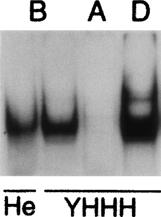 Fig. 4. Interaction of nuclear factors with MHC promoter elements. / Nuclear extracts from HeLa (He) and YHHH cells formed complexes with DNA probes representing the R1/α region of HLA-B (B) and H-2D (D) genes, but not the equivalent region from HLA-A (A). Super-shift analysis indicated that the predominant nuclear factors were CREB1 and USF1 (data not shown).