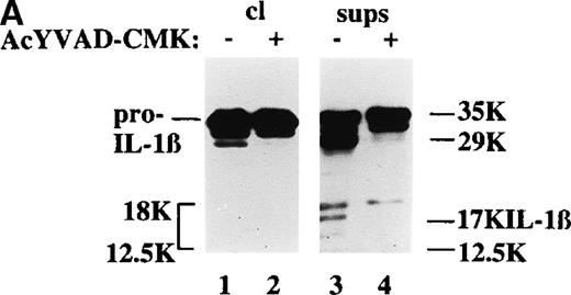 Fig. 5. ICE inhibition prevents the generation of ICE-specific bands but not the release of IL-1β bioactivity. / (A) Cell lysates (cl, lanes 1 and 2) or supernatants (sups, lanes 3 and 4) from DCs challenged for 8 hours with allogenic T cells at a T-cell:DC ratio of 10:1, in the absence (−, lanes 1 and 3) or presence (+, lanes 2 and 4) of 100 μmol/L AcYVAD-CMK, were analyzed as for their content in pro–IL-1β or IL-1β by Western blot. (B) Bioactivity of secreted IL-1β: aliquots of different dilutions (as indicated) of supernatants of DCs cultured 8 hours alone (○) with alloreactive T cells in the absence (▪) or presence (□) of 100 μmol/L AcYVAD-CMK were added to HUVEC and incubated at 37°C for 20 hours. At the end of the incubation, the ICAM1 molecules expressed by HUVEC were quantified by ELISA.