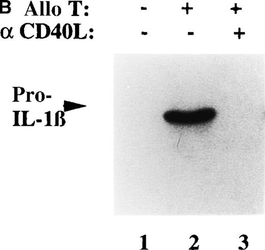Fig. 7. CD40-CD40L interaction is responsible for the induction of IL-1β synthesis by DCs. / (A) DCs were incubated for different periods as indicated with CD40L transfected cells at a CD40L+ cell:DC ratio of 1:1. At the end of each incubation time, the intracellular content in pro–IL-1β was analyzed by Western blot and quantified by densitometry. (B) DCs were incubated for 8 hours alone (lane 1) or with alloreactive T cells (lanes 2 and 3), that were untreated (lane 2) or pretreated for 30 minutes with anti CD40L antibody, at T-cell:DC ratio 10:1. At the end of incubation the intracellular content in pro–IL-1β was analyzed by Western blot.