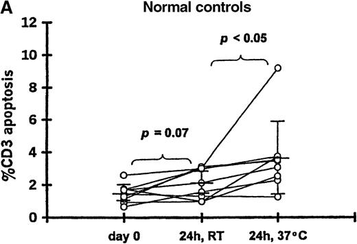Fig. 1. T-cell apoptosis before and after incubation of whole blood. / Whole blood was incubated 24 hours at room temperature (24h, RT) or at 37°C (24h, 37°C); prior to incubation is noted as day 0. Samples were obtained from (A) 9 controls and (B) 11 patients studied 20-102 days after transplantation.