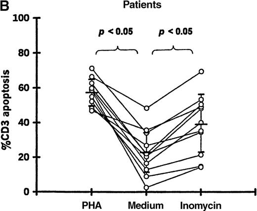 Fig. 5. T-cell apoptosis following stimulation by PHA or ionomycin. / Apoptosis was measured following 24-hour culture of PBMCs in (A) 11 controls and (B) 11 patients studied 19-87 days after transplantation.