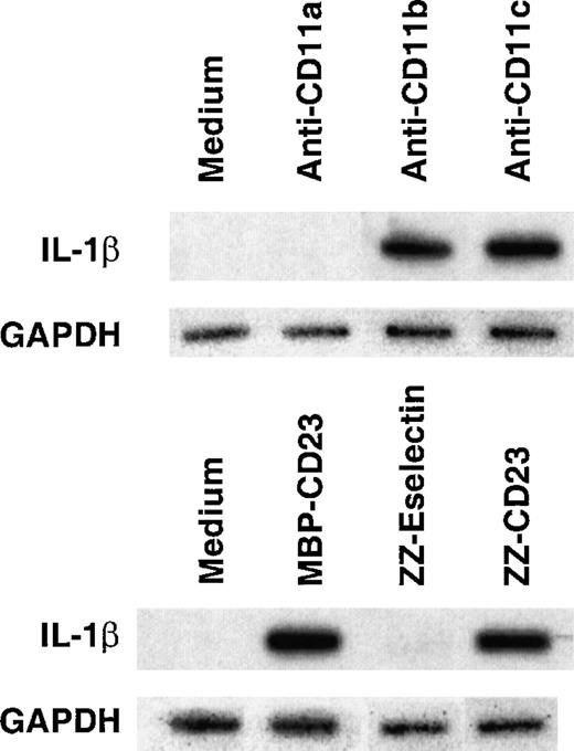Fig. 5. Determination of the transcriptional activity ofpro–IL-1β gene in isolated nuclei from human monocytes stimulated by β2 integrin engagement. / Nonadherent human monocytes (30 × 106 cells) were starved overnight in RPMI 1640 medium supplemented with 1% FCS and then stimulated for 1 hour with anti-CD11a (2 μg/mL), anti-CD11b (2 μg/mL), anti-CD11c (2 μg/mL), MBP-CD23 (1 μg/mL), ZZ-Eselectin (1 μg/mL), or ZZ-CD23 (1 μg/mL). Then cells were lysed, nuclei isolated, and in vitro transcription performed as described in “Materials and methods.” Results are representative of 3 distinct experiments.