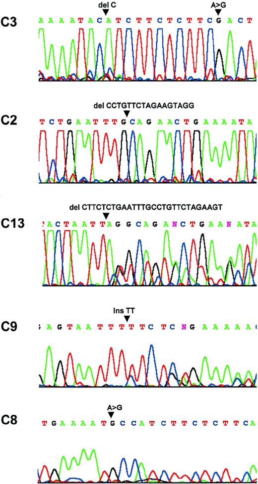 Fig. 2. Sequence analysis. / Patient C3: a C deletion at nucleic acid 554 and a substitution at nucleic acid 567. Patient C2: a 17-bp deletion between nucleic acids 522 and 539. Patient C13: a 28-bp deletion between nucleic acids 508 and 536. Patient C9: a TT insertion at nucleic acid 428. Patient C8: a substitution at nuclei acid 553.