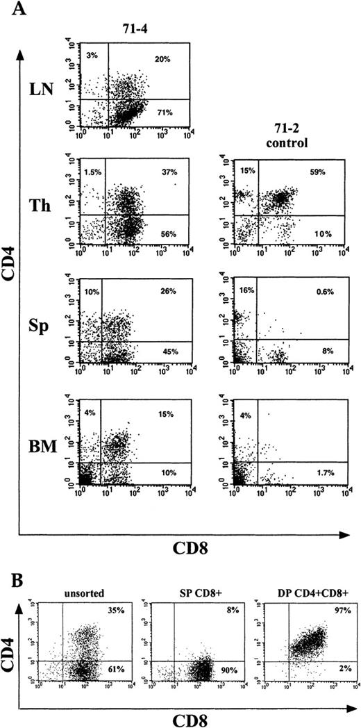 Fig. 4. : CD4 and CD8 expression in TEL-JAK2 leukemic cells. / (A) Single-cell suspensions from lymph nodes (LN), thymus (Th), spleen (Sp), and bone marrow (BM) were obtained from a transgenic leukemic animal (71-4) and its sibling control (71-2). (B) Single-cell suspensions obtained from a tumor generated in nude mice (Nu18; Table3) were sorted as CD8+ SP and CD4+CD8+ DP as described in “Materials and methods.” The CD4 and CD8 expression pattern of unsorted cells (left), CD8+ SP cells (middle), and DP cells (right) was determined by flow cytometry. For each experiment, 106cells were incubated with anti-CD4–PE (Y-axis) and anti-CD8–FITC (X-axis) and analyzed by flow cytometry. The results were computed from the acquisition of 10 000 events. The relative percentage of each subpopulation (CD4+CD8−; CD4−CD8+; and CD4+CD8+) is indicated in the corresponding area of the diagrams.