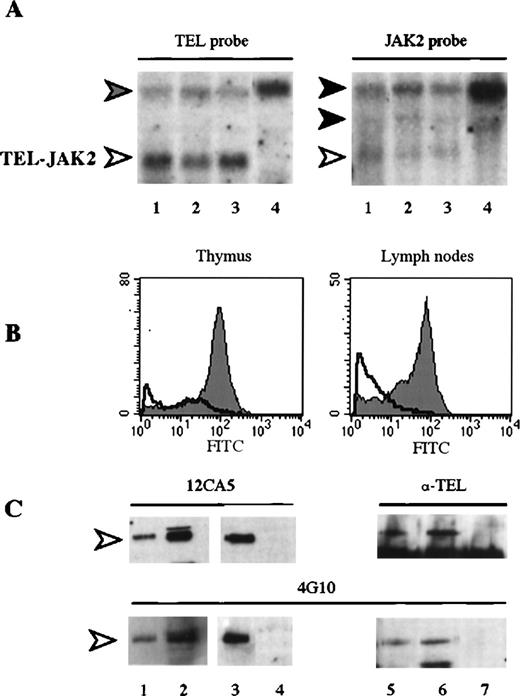 Fig. 5. Expression of HA-TEL-JAK2 transgene. / (A) Northern blot analysis. Total mRNA from diseased spleen (lane 1), thymus (lane 2), lymph nodes (lane 3), and from a control spleen (lane 4) were hybridized as indicated with probes specific for TEL or JAK2. The TEL-JAK2 transgene mRNA is indicated by a white arrowhead. Bands corresponding to the endogenous TEL and JAK2 transcripts are indicated by gray and black arrowheads, respectively. (B) Flow cytometric detection of HA-TEL-JAK2 protein expression in diseased thymus and lymph nodes. Double labeling with mouse anti-Thy1.2–PE and rabbit anti-HA plus antirabbit Ig-FITC antibodies revealed that Thy1.2+ cells express the HA epitope. For the thymus, FITC-fluorescence intensity in gated Thy1.2+ cells is represented for a transgenic animal (71-10, dark surface) and for a control animal (71-6, open surface). For diseased lymph nodes, labeling is with the anti-HA rabbit antibody plus antirabbit Ig-FITC (dark surface) or with antirabbit Ig-FITC alone (open surface). (C) Western blot analysis of cellular extracts from lymph nodes, thymus, and spleen from diseased and control animals. Extracts corresponding to the same number of cells from each organ were immunoprecipitated by anti-JAK2 antibody, separated by SDS-PAGE, and blotted on nitrocellulose. Blots were analyzed with either the anti-HA (12CA5, Boehringer) or anti-TEL23 antibodies (upper panel) or with the 4G10 phosphotyrosine-specific antibody (lower panel). Lanes 1 and 2: lymph nodes from transgenic animals 71-4 and 71-18. Lanes 3 and 5: thymus from transgenic mice 65 and 71-18. Lane 6: spleen from transgenic mouse 71-18. Lanes 4 and 7: control thymus and spleen, respectively. The HA-TEL-JAK2 protein is indicated by a white arrowhead.