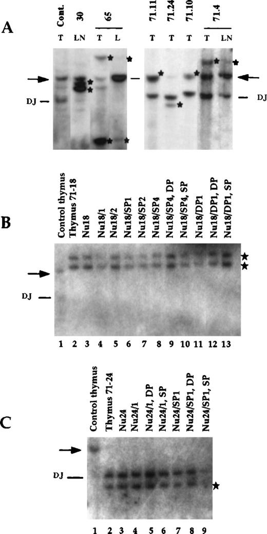 Fig. 7. TCRβ gene rearrangement in TEL-JAK2 leukemic cells. / (A) DNA was extracted from the thymus (T) from founder mouse 65, from 4 F1 animals of transgenic line 71 (71-11, 71-24, 71-10, and 71-4), and from a control thymus. Lymph nodes (LN) from transgenic mice 30 and 71-4 and the liver (L) from mouse 65 were also analyzed. DNA were digested by HindIII and analyzed by Southern blot using a jβ2-specific probe. An arrow points to germline configuration. TCRβ-rearranged bands (indicated by stars) are prominant in all leukemic samples. (B) DNA was extracted from a control thymus (lane 1), from the thymus of a diseased transgenic mouse 71-18 (lane 2), from nude mice tumors obtained following transplantation either of the leukemic cells of animal 71-18 (Nu18, lane 3) or following secondary transplantation of Nu18 tumor cells (lanes 4 and 5), from nude mice tumors obtained from the transplantation of sorted SP (lanes 6-8) or DP cells (lane 11), and from the sorted CD8+SP and DP populations derived from transplanted tumors Nu18/SP4 and Nu18/DP1 (lanes 9-10 and 12-13) (see also Table 3). DNA were digested by HindIII and analyzed by Southern blot using a jβ2-specific probe. Germline configuration is indicated by an arrow. TCRβ-rearranged bands (indicated by stars) are prominant in all leukemic samples. (C) DNA was extracted from a control thymus (lane 1), from the thymus of diseased transgenic mouse 71-24 (lane 2), from nude mice tumors obtained either following transplantation of the leukemic cells of animal 71-24 (Nu24, lane 3) or following secondary transplantation of Nu24 tumor cells (Nu24/1, lane 4), from nude mice tumors obtained from the transplantation of sorted SP (Nu24/SP1, lane 7), and from the sorted DP and CD8+ SP populations derived from either transplanted tumors Nu24/1 (lanes 5 and 6) or Nu24/SP1 (lanes 8 and 9) (see also Table 3). DNA were digested byHindIII and analyzed by Southern blot using a jβ2-specific probe. Germline configuration is indicated by an arrow. TCRβ-rearranged bands (indicated by stars) are prominant in all leukemic samples.