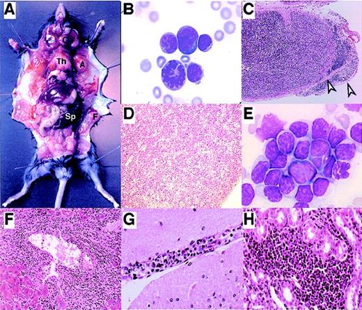 Fig. 2. : Histopathological and cytologic analysis of TEL-JAK2 transgenic mice. / (A) Macroscopic appearance of an F1 transgenic mouse showing hyperplasia of spleen (Sp); thymus (Th); and cervical (C), axillary (A), and femoral (F) lymph nodes. (B) May-Grünwald-Giemsa (MGG) staining of blood smears of transgenic mice. Note the morphology resembling that of prolymphocytes, the size heterogeneity, and the presence of a mitotic cell. (C-E) Histopathology of hematopoietic organs. (C) Thymus showing invasion of the perilobular capsule (white arrows) (HE). (D) Spleen; note the loss of its normal architecture (HE). (E) Bone marrow; note infiltration by leukemic cells (MGG). (F and G) Histopathology of nonhematopoietic organs (HE) showing infiltration of leukemic cells in the (F) pericentrolobular area and sinusoids of the liver (HE) and (G) brain; subarachnoid area (HE). (H) Kidney; infiltration of leukemic cells around peritubular capillaries (HE).