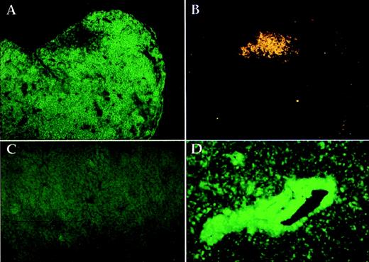 Fig. 3. Infiltrating lymphoid cells in TEL-JAK2 transgenic mice are T cells. / A lymph node section from a diseased mouse was double stained with anti-Thy1.2–FITC antibody and anti-B220–PE antibody and examined for expression of Thy1.2 (A) or B220 (B). A nontransgenic liver section (C) and the liver section from a diseased mouse (D) were stained with anti-Thy1.2 antibody.