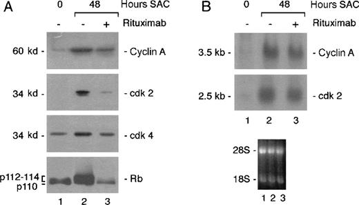 Fig. 3. Rituximab blocks hyperphosphorylation of Rb and induction of cell cycle proteins. / Resting tonsillar B cells were stimulated with SAC in the presence or absence of 2 μg/mL rituximab. (A) Total protein extracts were prepared from 1.5 × 106 cells for each time point and analyzed in Western blots with the indicated antibodies. (B) Total RNA was extracted at the indicated times. RNA (20 μg/mL) was analyzed by Northern blot analysis using the indicated probes. The lower panel shows the photograph of the ethidium bromide stained blot. The data are representative of 2 independent experiments.