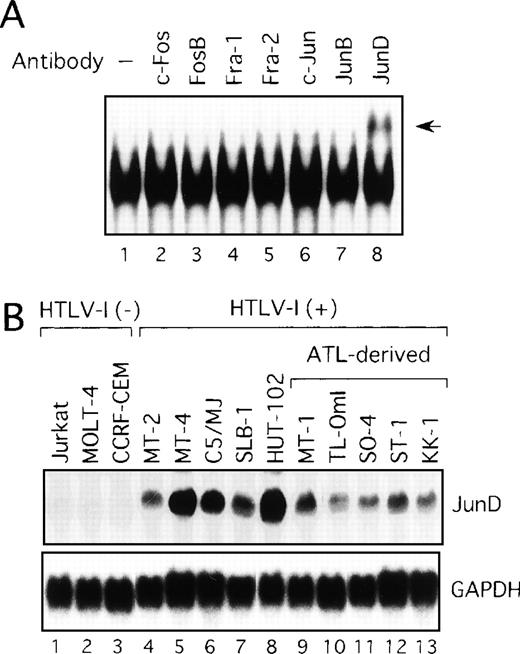 Fig. 2. Activation of JunD in HTLV-I-infected T-cell lines. / (A) Nuclear extracts of the ATL-derived cell line, MT-1, contain AP-1 binding activity, involving JunD. The antisera indicated above lanes were incubated with nuclear extracts from MT-1 cells and subjected to EMSA using IL-8 AP-1 as a probe. A supershift band was observed on addition of antisera against JunD (arrow). (B) Expression of JunD mRNA determined by Northern blot analysis of HTLV-I-infected T-cell lines. GAPDH expression was used as a control.
