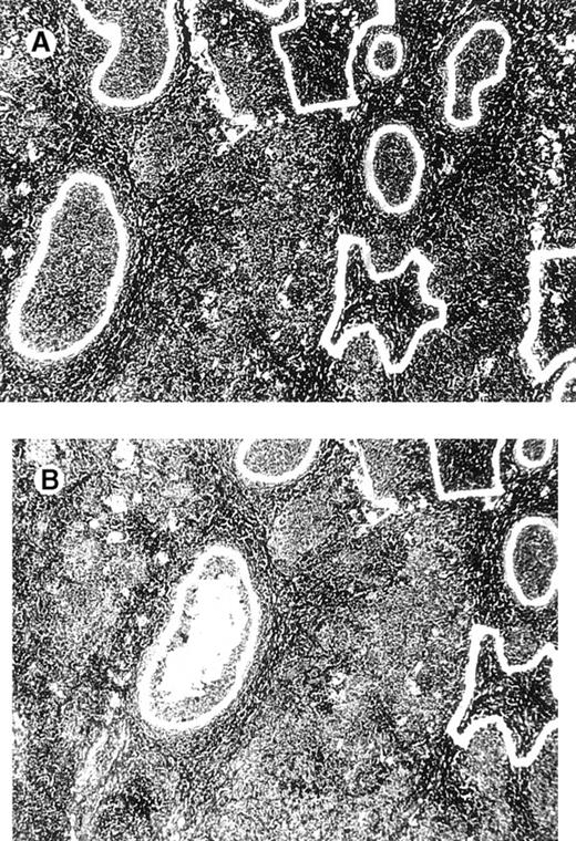 Fig. 1. Computerized microdissection. / (A) Preparation of follicle center cells and interfollicular cells by laser beam for computerized microdissection. (B) Detail of the specimen after computerized microdissection of 1 follicle.