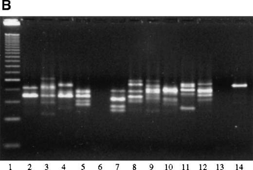 Fig. 8. PCR analysis of microdissected specimens. / (A) Example of a monoclonal pattern of JH gene rearrangement of cells within the follicles after laser-based microdissection in 1 patient with FCL (patient 9). Lanes: 1 to 5, 5 different follicles; 6 to 11, 6 different interfollicular areas; 12, negative control (no DNA, external PCR run); 13, positive control (cutaneous B-cell lymphoma); 14, negative control (no DNA, internal PCR run); 15, molecular ladder. (B) Example of a polyclonal pattern of JH gene rearrangement of follicle center cells and interfollicular cells after laser-based microdissection in 1 patient with FCL (patient 6). Lanes: 1, molecular ladder; 2 to 7, 6 different follicles; 8 to 12, 5 different interfollicular areas; 13, negative control (no DNA, external PCR run); 14, positive control (cutaneous B-cell lymphoma). (C) Marginal zone lymphoma reveals monoclonality of interfollicular cells and polyclonal pattern of reactive germinal centers. Lanes: 1 to 4, reactive germinal centers; 5 to 9, interfollicular areas; 10, molecular ladder. One of the bands in lane 4 may represent follicular colonization by neoplastic marginal zone cells.