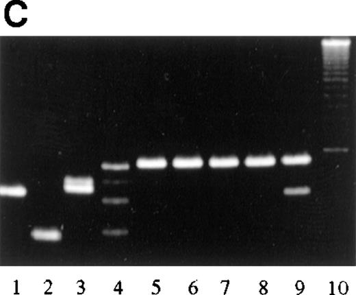 Fig. 8. PCR analysis of microdissected specimens. / (A) Example of a monoclonal pattern of JH gene rearrangement of cells within the follicles after laser-based microdissection in 1 patient with FCL (patient 9). Lanes: 1 to 5, 5 different follicles; 6 to 11, 6 different interfollicular areas; 12, negative control (no DNA, external PCR run); 13, positive control (cutaneous B-cell lymphoma); 14, negative control (no DNA, internal PCR run); 15, molecular ladder. (B) Example of a polyclonal pattern of JH gene rearrangement of follicle center cells and interfollicular cells after laser-based microdissection in 1 patient with FCL (patient 6). Lanes: 1, molecular ladder; 2 to 7, 6 different follicles; 8 to 12, 5 different interfollicular areas; 13, negative control (no DNA, external PCR run); 14, positive control (cutaneous B-cell lymphoma). (C) Marginal zone lymphoma reveals monoclonality of interfollicular cells and polyclonal pattern of reactive germinal centers. Lanes: 1 to 4, reactive germinal centers; 5 to 9, interfollicular areas; 10, molecular ladder. One of the bands in lane 4 may represent follicular colonization by neoplastic marginal zone cells.