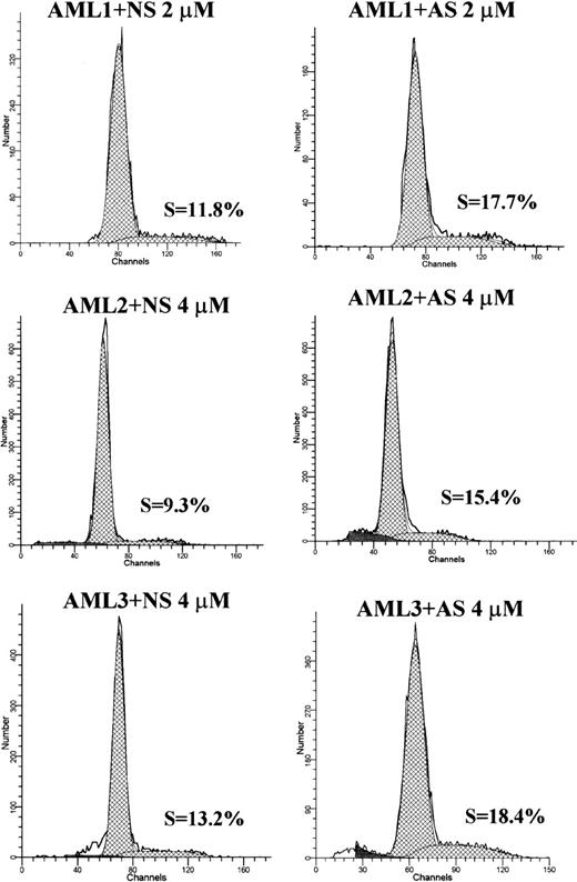 Fig. 9. DNA histograms of Bcl-2-AS- or NS-treated leukemic cells from 3 AML samples. / Cellular DNA content was measured by acridine orange as described in “Materials and methods.” The curve fitting software (ModFit) allowed the determination of the percentage of cells in different phases of cell cycle. In all samples shown, S-phase increased in Bcl-2-AS–treated samples, compared with NS controls.
