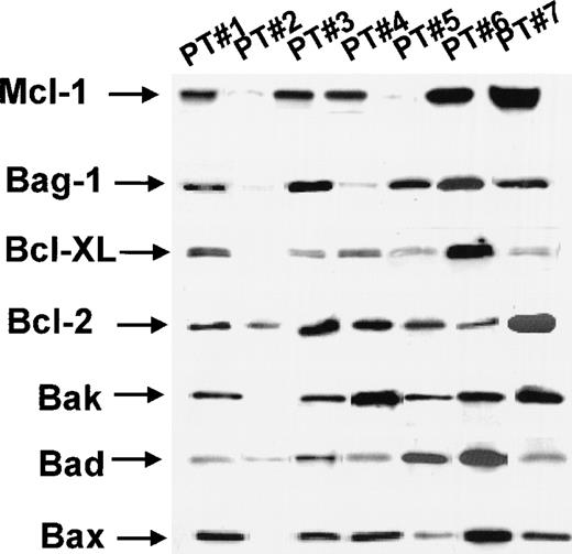 Fig. 12. Expression of Bcl-2 family proteins in AML by Western blot analysis. / For details, see “Results.”