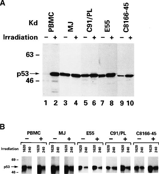 Fig. 1. p53 induction after ionizing radiation treatment of HTLV-I–infected cells. / (A) Western blot analyses of total protein lysate with the anti-p53 antibody 7. (B) Immunoprecipitation was performed with the antibody 1620 (for wild-type conformation) or 240 (for mutant conformation), followed by immunoblotting with anti-p53 antibody 7. + and − refer to the presence and absence, respectively, of ionization–radiation treatment.