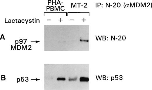 Fig. 5. p53 stabilization is increased by lactacystin treatment of PHA–PBMC and MT-2 cells. / Normal PHA–PBMC and MT-2 cells were treated with lactacystin, and the cell lysates were immunoprecipitated with the N-20 antibody. The blots were immunoblotted first with the N-20 antibody (A) and, after stripping, with the FL-393 antibody (B). + and − refer to the presence or absence of the drugs, respectively.