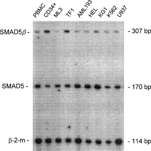 Fig. 3. Expression of SMAD5β in hematopoietic and leukemic cells. / A representative autoradiograph of multiplexed RT-PCR products resolved on a poly-A site. The upper band (307 bp) representsSMAD5β; the middle band (170 bp) represents the full-length SMAD5; and the lower band (114 bp) represents the internal control, β-2-m. Templates used for amplification are as indicated: peripheral blood mononuclear cells (PBMCs), normal bone marrow progenitor cells (CD34+), acute myelogenous leukemia (ML-3), erythroleukemia (TF1), acute myelogenous leukemia (AML193), erythroleukemia (HEL), acute myelogenous leukemia (KG1), chronic myelogenous leukemia in erythroid blast crisis (K562), and myelomonocytic leukemia (U937).