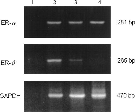 Fig. 6. ER gene expression in human monocytes and neutrophils. / RT-PCR was performed using either no RNA (negative control, lane 1) or 3 μg RNA from human breast cell lines (positive control, lane 2), monocytes (lane 3), or neutrophils (lane 4). MCF7 and MDA MB231 cell lines were used for ERα and ERβ amplification controls, respectively. PCR amplification was also performed using a primer pair specific for human GAPDH as a cDNA control. The PCR products (one-fifth of the ERα and ERβ amplification, one-tenth of the GAPDH amplification) were separated by electrophoresis on a 2% agarose gel. DNA markers (1-kb ladder) were run in parallel. The sizes of the amplified products are indicated in the base pair on the right.
