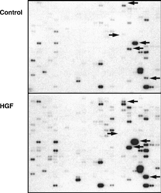Fig. 2. Hepatocyte growth factor (HGF)–stimulated gene-expression profile of isolated monocytes. / Autoradiograph of a complementary DNA (cDNA)-expression array, which consisted of 2 identical filters each spotted with duplicate cDNA samples of 588 genes hybridized with phosphorus 32–labeled total cellular cDNA obtained from unstimulated (control) and HGF-stimulated monocytes. Semiquantitative comparison of the 2 filters was done. Some examples of obvious changes in gene expression are indicated by arrows. The autoradiograph corresponds with the PhosphoImager data in Table 1(monocyte fraction).