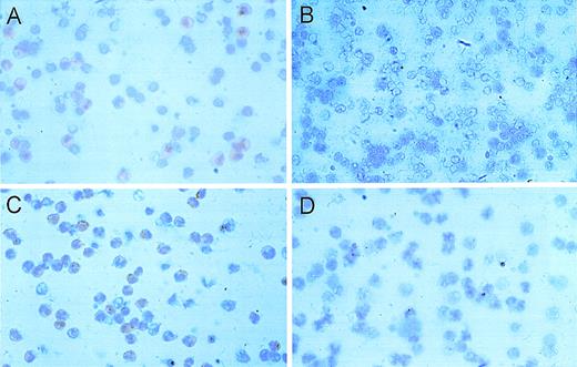 Fig. 1. Expression of MET receptor in peripheral blood mononuclear cells (PBMNC). / Immunocytologic detection of MET receptor in PBMNC (A) and monocytes (C) derived from a healthy donor by using a rabbit polyclonal MET antibody. The specificity of the signal was demonstrated by control experiments for PBMNC (B) and monocytes (D) using the MET antibody after preabsorption with a specific binding peptide. (E) Determination of monocyte concentrations by fluorescence-activated cell-sorter analysis using fluorescein isothiocyanate–labeled anti-CD14 (right) antibodies in the PBMNC fraction (above) and the negatively selected monocyte fraction (below). The respective unstained cell fractions are shown on the right side. The calculation resulted in a purity of the monocytic fraction of greater than 90%.