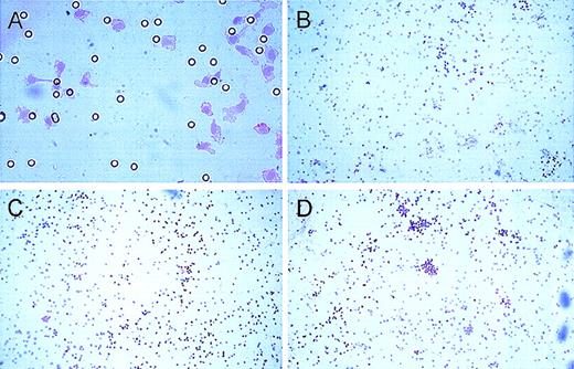 Fig. 3. HGF-induced matrigel invasion of isolated monocytes. / Primary cultured monocytes migrate into matrigel, pass through a porous membrane filter, and adhere to the bottom side, where they are fixed and counterstained. (A) Several cells may simultaneously pass through a single pore (400 × magnification of the bottom side of a polycarbonate membrane filter). Invasions of unstimulated (B) and HGF-stimulated monocytes with diffuse (C) and irregular (D) cell distribution after 18 hours of incubation are shown (100-fold magnification of the bottom side of the membrane).