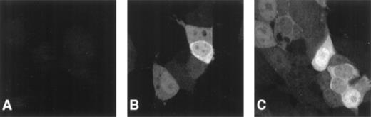 Fig. 1. Heterogeneous cellular expression of FANCC. / Cells were stained with monoclonal anti-FANCC antibody and a secondary Oregon green–labeled goat antimouse antibody. Fluorescence was observed using a confocal imaging system. A single slice through the plane of cells is displayed. (A) 293 NEO cells. No staining of endogenous FANCC is detectable. (B) 293 FANCC E2 cells. In this field, 1 cell has a large amount of cytoplasmic FANCC, whereas an adjacent cell is only weakly positive. (C) 293 FANCE2 cells. Some cells have only cytoplasmic FANCC, others have predominately nuclear FANCC, and some have FANCC in both compartments. Nuclear foci are clearly visible in the top and bottom cells. In addition to the subcellular localization differences, there is marked cell-to-cell variation in total cellular FANCC expression.