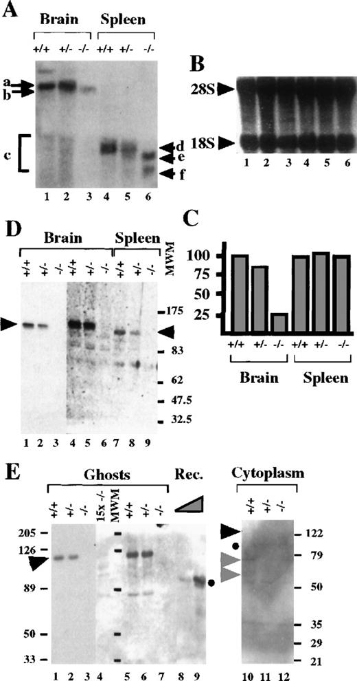 Fig. 3. RNA and protein analysis of the β-adducin −/− mice. / (A) Northern blot analysis of brain and spleen β-adducin mRNA from adult wild-type (+/+), heterozygous (+/−), and homozygous mutant (−/−) mice. The arrows indicate the different β-adducin mRNA species detected. (B) Methylene blue staining of the membrane utilized in A. (C) The signals obtained in A were normalized against the 18S RNA content present in the membrane. RNA levels are expressed as a percentage of the RNAs of wild-type mice for each tissue. (D) Western blot analysis of brain (lanes 1-6) and spleen (lanes 7-9) protein extracts (30 μg) from adult wild-type (+/+), heterozygous (+/−), and homozygous mutant (−/−) mice using a rabbit anti-mouse β-adducin Δ9-13 polyclonal antibody. Lanes 4-6 are a 15× overexposure of the blot shown in lanes 1-3. The β-adducin (β-Add97 form) bands are marked by black arrows. (E) Western blot analysis of ghost proteins (lanes 1-3, 0.7 μg; lane 4, 10 μg), bacteria purified recombinant mouse β-adducin Δ9-13 (lanes 8 and 9, containing 2 and 5 ng of purified protein, respectively), and RBC cytoplasmic proteins (lanes 10-12, 100 μg) was revealed with the same antibody utilized in panel D. Lanes 1 to 3 are a lower exposure of the blot shown in lanes 5 to 7. The β-adducin (β-Add97 form) and the recombinant β-adducin Δ9-13 product (Rec.) are marked by a black arrow and a black dot, respectively. The lower molecular weight bands seen in lane 10 are marked by gray arrows.