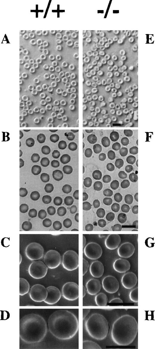 Fig. 4. Morphology of RBCs. / Native (A and E) and May-Gruenwald Giemsa stained (B and F) light microscopy and scanning electron (C, D, G, and H) microscopy of peripheral blood smears of wild-type (A, B, and C) and mutant (D, E, and F) mice. The abnormal morphology and the decrease in the concavity of erythrocytes of mutant mice is seen. Bar 10 μm (A, B, C, E, F, and G), 5 μm (D and H).