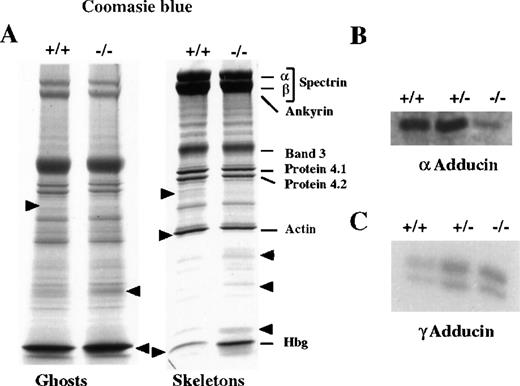 Fig. 6. Analysis of ghost and skeletal proteins in β-adducin mutant mice. / (A) Coomassie blue stained gels (SDS-PAGE) of ghosts and membrane skeletons (30 μg and 35 μg for ghost and skeleton, respectively) from normal (+/+) and mutant (−/−) mice. The major proteins are indicated. Variations between normal and mutant animals are indicated by arrows. (B and C) Western blot analysis of ghost proteins (3 μg and 8 μg, respectively) of adult wild-type (+/+), heterozygous (+/−), and homozygous mutant (−/−) mice using a rabbit anti-rat α-adducin polyclonal antibody (panel B) or a rabbit anti-mouse-γ-adducin antibody (panel C).